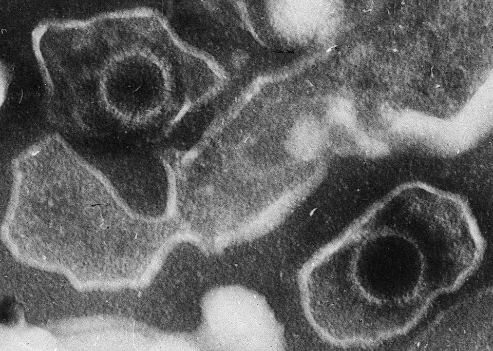 Black-and-white electron micrograph showing two Epstein–Barr virus particles with round capsids surrounded by a membrane envelope.